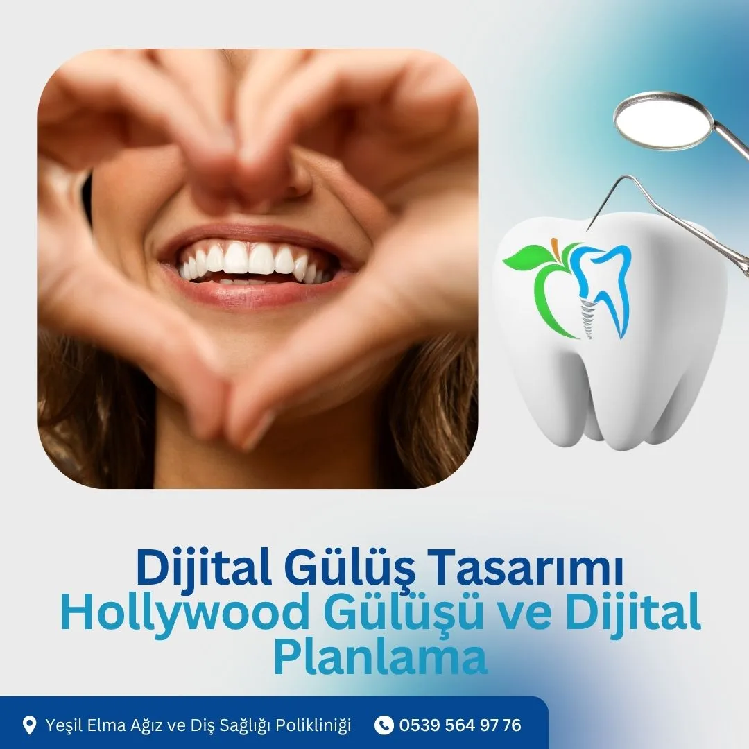 Dijital Gülüş Tasarımı
