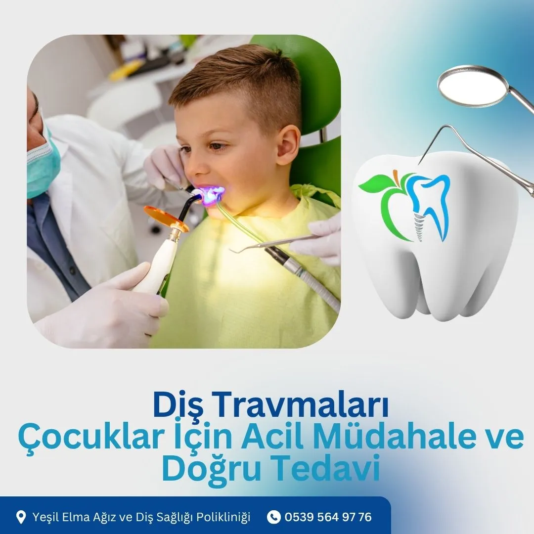 Diş Travmaları