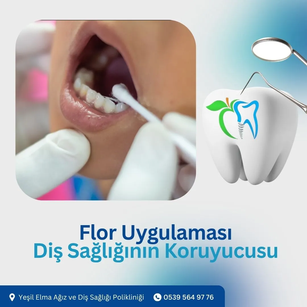 Flor Uygulaması