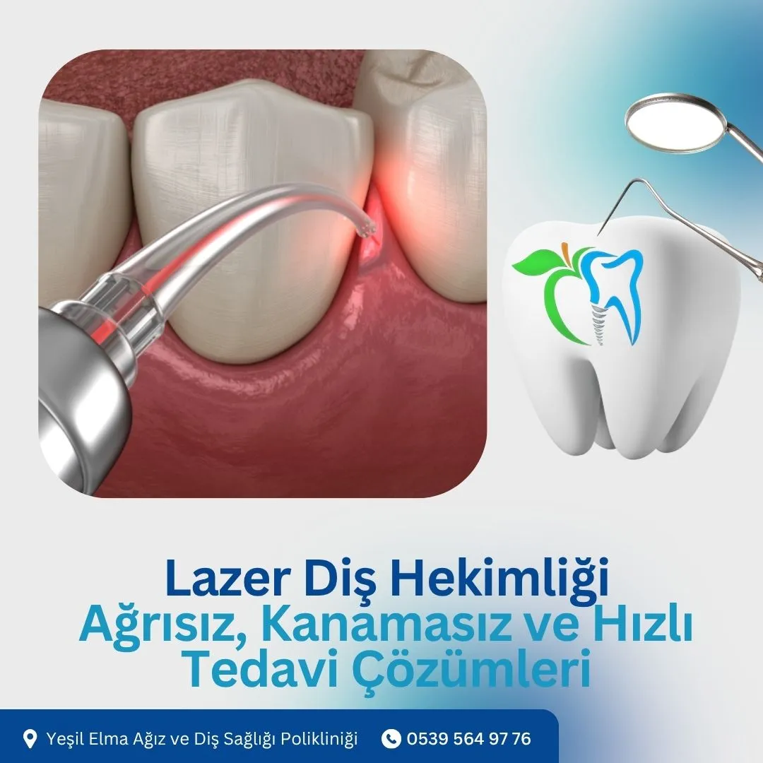 Lazer Diş Hekimliği