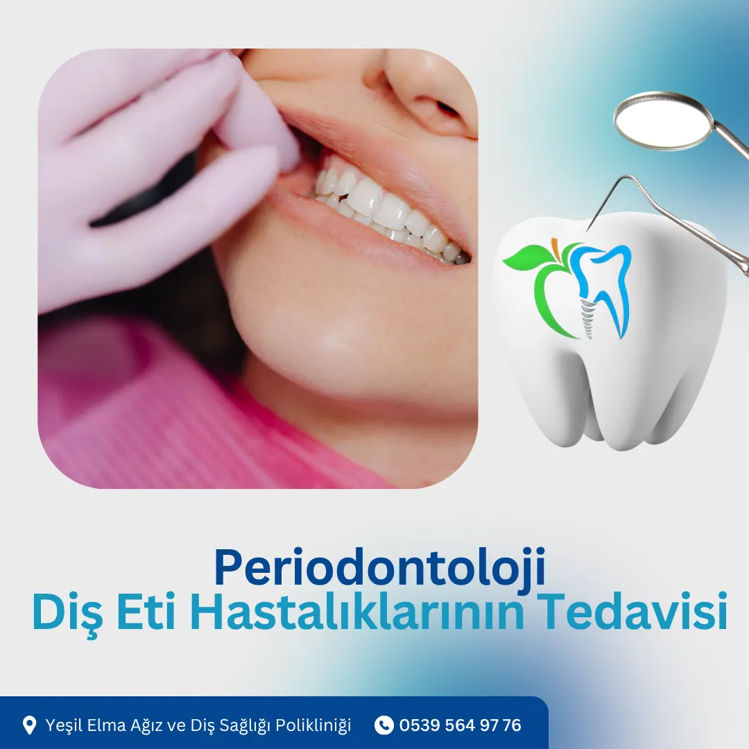 Periodontoloji: Diş Eti Hastalıkları